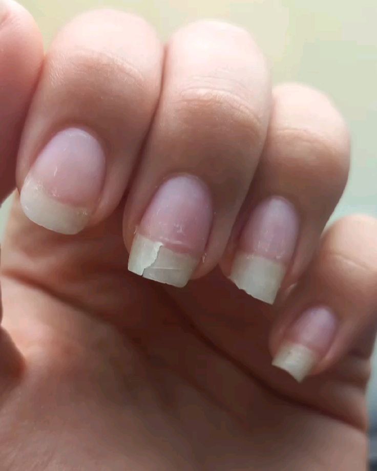 Ongles après